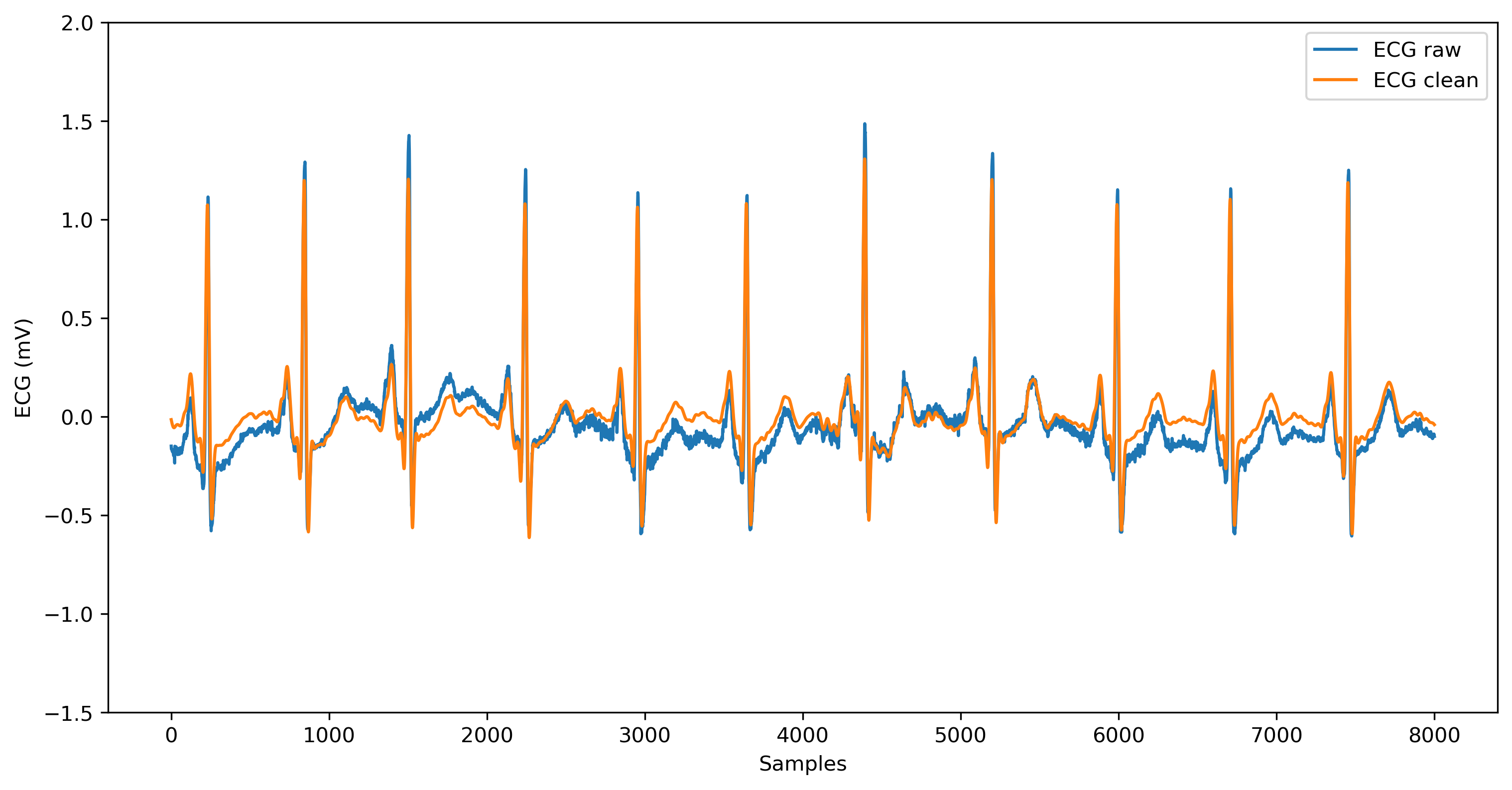ECG cleaned vs raw