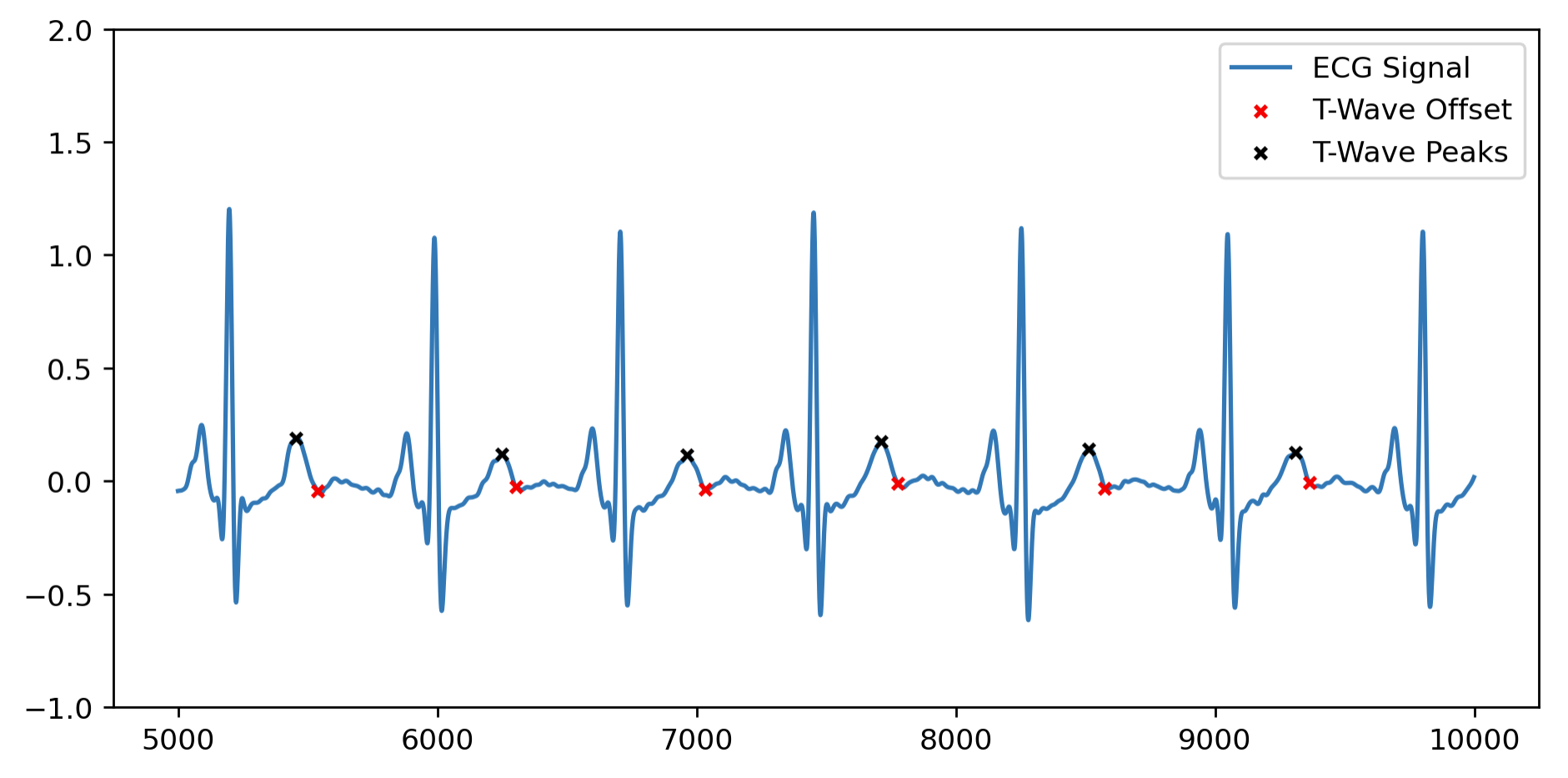 T-wave delineation